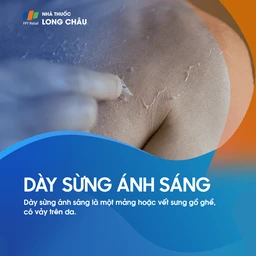 Dày sừng ánh sáng 1