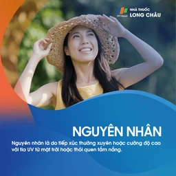 Dày sừng ánh sáng 3