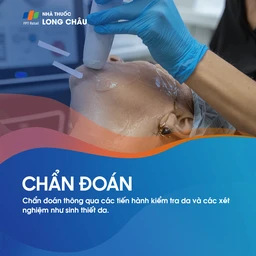 Dày sừng ánh sáng 5
