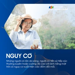Đối tượng có nguy cơ cao bị đồi mồi thường là phụ nữ trung niên, đặc biệt trong và sau thời kỳ mang thai