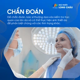 Cách chẩn đoán đồi mồi thường dựa vào khám ngoại khoa da liễu và đánh giá lâm sàng về mức độ và mẫu phân bố của các vết sắc tố
