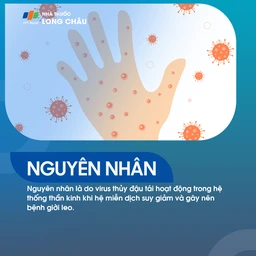 bệnh giời leo, thường liên quan đến sự tái hoạt động của virus varicella-zoster ở người đã từng mắc thủy đậu