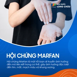 Hội chứng Marfan 1