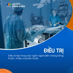 Hội chứng Marfan 5