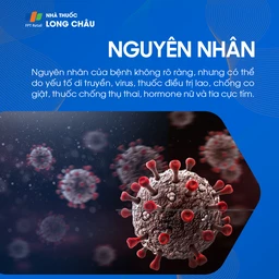 Virus là yếu tố khởi phát lupus ban đỏ