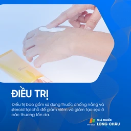 Cách điều trị tổn thương da do lupus