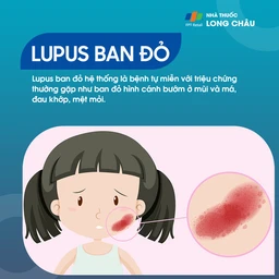 Lupus Ban Đỏ Hệ Thống 1