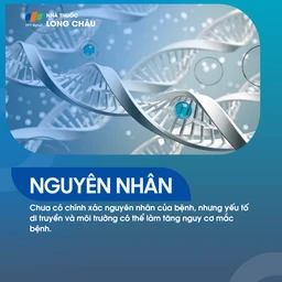 Lupus Ban Đỏ Hệ Thống 3