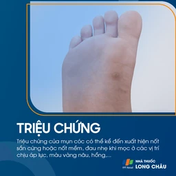 Mụn cóc ở lòng bàn chân – mụn lõm, có chấm đen ở giữa, gây đau khi di chuyển