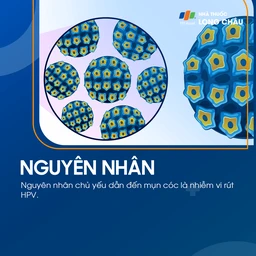 Nguyên nhân mụn cóc là do Virus HPV
