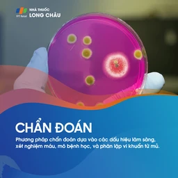 Quá trình chẩn đoán bệnh mụn nhọt bằng cách lấy mẫu từ các nốt mụn để xét nghiệm