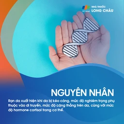 nguyên nhân của rạn da, bao gồm sự tăng cân nhanh và thay đổi nội tiết tố trong thai kỳ