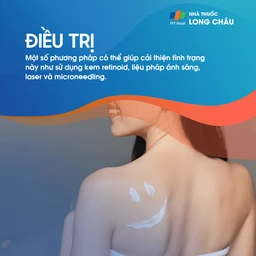 Sử dụng các loại kem và dầu bôi trị rạn da để cải thiện độ đàn hồi của da