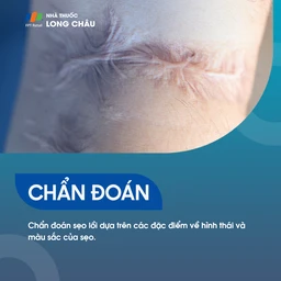 Sẹo Lồi 5