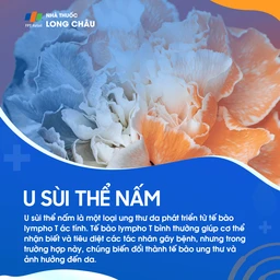 U sùi thể nấm 1