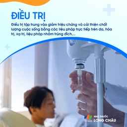 U sùi thể nấm 6