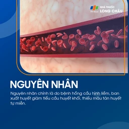 Vàng da tán huyết 3