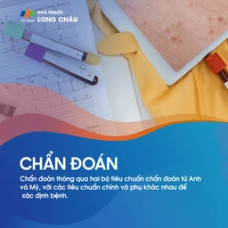 Chẩn đoán viêm da cơ địa