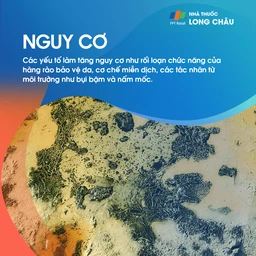 Viêm Da Dị Ứng 5