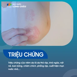 Viêm da: Triệu chứng đỏ, ngứa và phát ban trên da