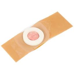 Miếng dán mụn cóc Kangdi Fobelife (6 miếng)