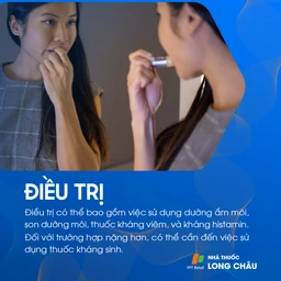Điều trị chàm môi bằng kem dưỡng ẩm và thuốc bôi chống viêm