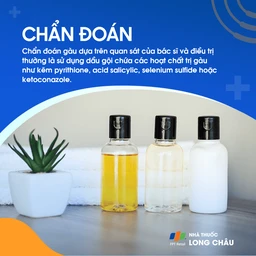 Chẩn đoán gầu dựa trên kiểm tra lâm sàng da đầu và lịch sử bệnh lý