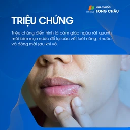Herpes môi: Triệu chứng mụn nước, ngứa và đau rát trên môi