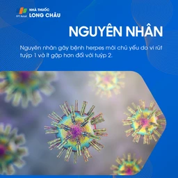 Nguyên nhân gây herpes môi như virus Herpes simplex và cách chẩn đoán