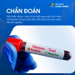 Cách chẩn đoán bệnh Herpes môi