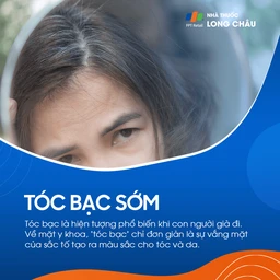 Tóc bạc sớm 1