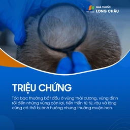Tóc bạc sớm 2