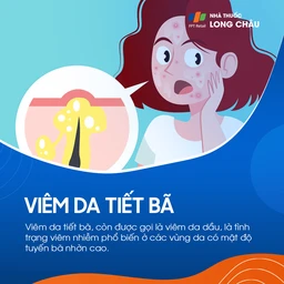 Viêm Da Tiết Bã 1