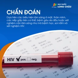Chẩn đoán viêm da tiết bã qua kiểm tra da liễu và tư vấn chuyên gia