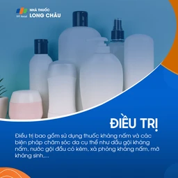 Điều trị viêm da tiết bã bằng kem chống nấm và thuốc bôi chứa corticoid