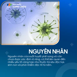 Xuất huyết phế nang vô căn 3