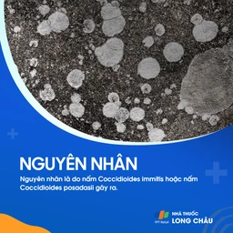 Bệnh nấm coccidioimycosis 4