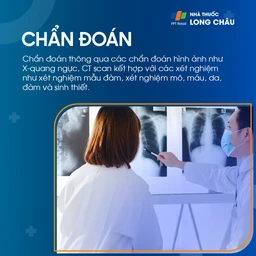 Nhiễm nấm Aspergillus 6