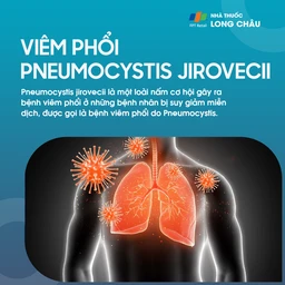 Viêm phổi Pneumocystis jirovecii 1
