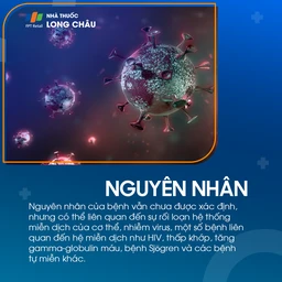 Viêm phổi kẽ lympho bào 3