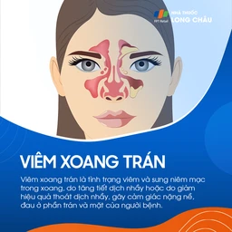 Viêm xoang trán 1