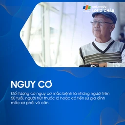 Xơ phổi vô căn 4