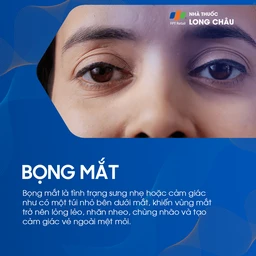 Bọng mắt là tình trạng sưng nhẹ dưới mắt, khiến mắt trông mệt mỏi, nhăn nheo và chùng nhão