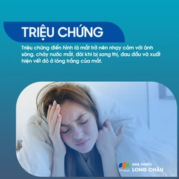 Triệu chứng phổ biến của đau hốc mắt gồm chảy nước mắt, nhạy cảm ánh sáng, song thị, đau đầu và xuất hiện vết đỏ ở lòng trắng mắt