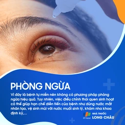Hội chứng Sjogren 7