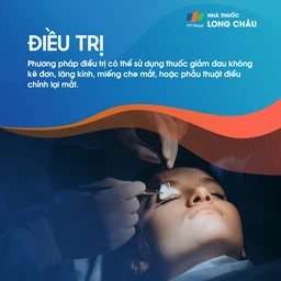 Liệt dây thần kinh số IV 6