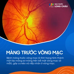Màng trước võng mạc 1