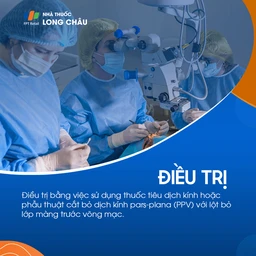 Màng trước võng mạc 6