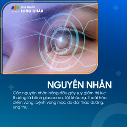 Suy giảm thị lực 3