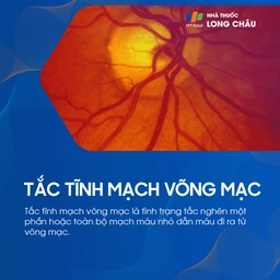 tắc tĩnh mạch võng mạc 1